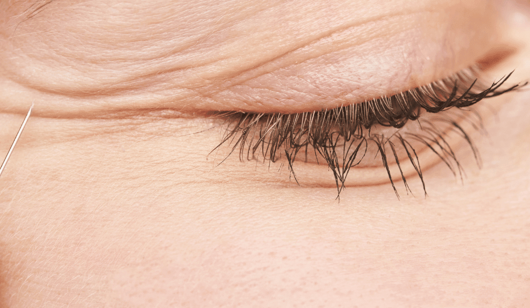 The Most Effective Ways To Defeat Crow’s Feet – At Home Or At Your Favourite Clinic!