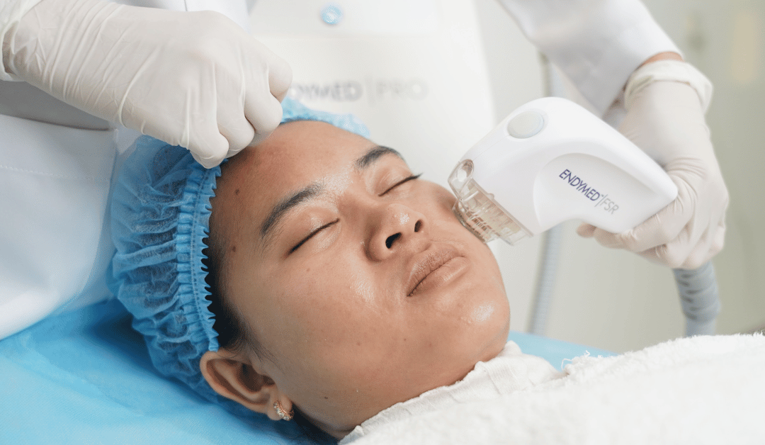 ទទួលបានភាពស្រស់ស្អាតសារជាថ្មី៖ មគ្គុទ្ទេសក៍ស្តីពីសេវា Skin Rejuvenation