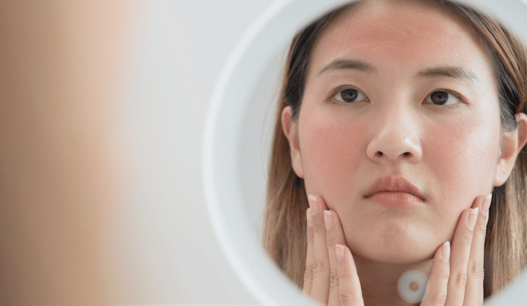 ការព្យាបាលតម្រូវតាមស្ថានភាពស្បែកជាក់លាក់របស់អ្នក