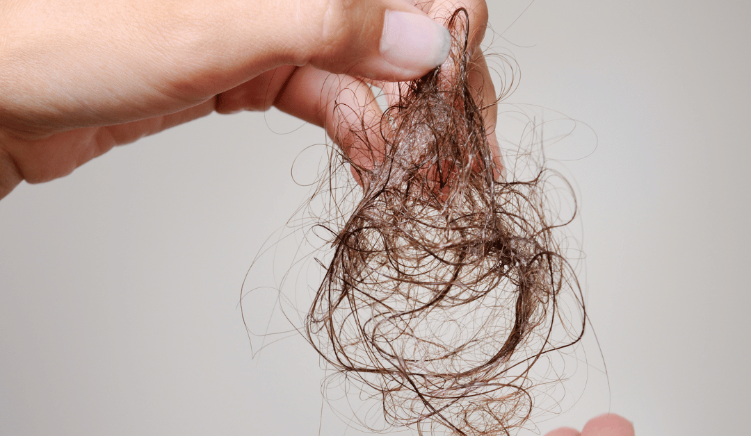 Woman losing hair needing har loss treatment